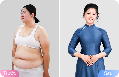 Giảm béo cấu trúc đa công nghệ