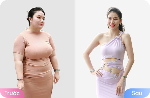 Giảm béo cấu trúc đa công nghệ