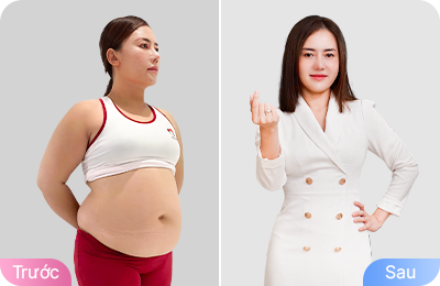 Giảm béo cấu trúc đa công nghệ