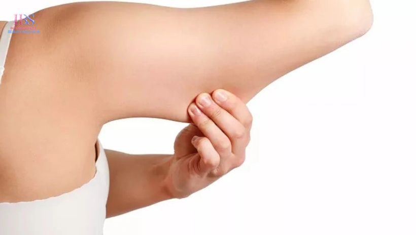 Bí quyết chọn dịch vụ giảm mỡ bắp tay uy tín 