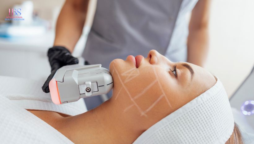 Nâng cơ mặt Hifu 4D