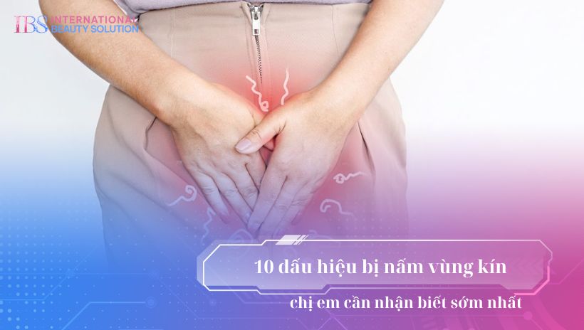 10 dấu hiệu bị nấm vùng kín chị em cần nhận biết sớm nhất