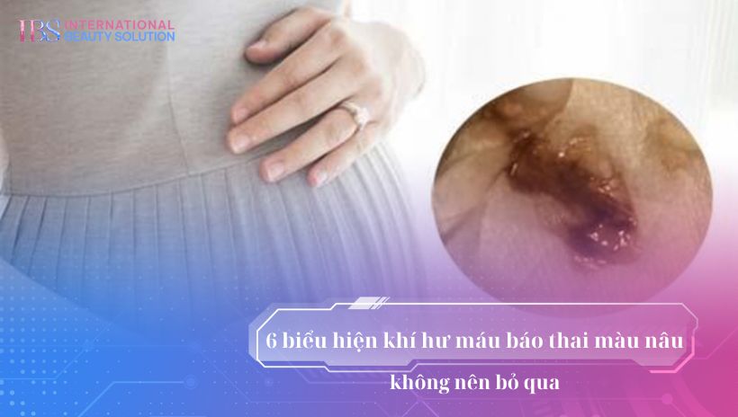 6 biểu hiện khí hư máu báo thai màu nâu không nên bỏ qua