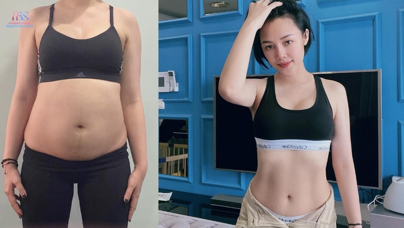 Những sai lầm cần tránh khi giảm béo sau sinh