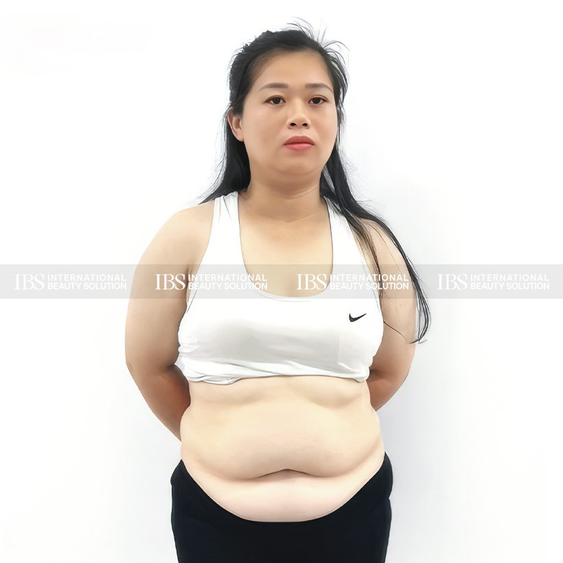 Chị Thanh Tâm trước khi giảm cân 