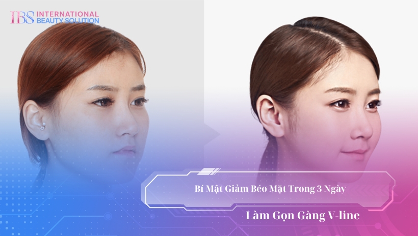 Bí mật giảm béo mặt trong 3 ngày