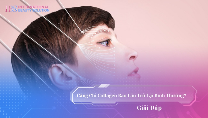 Căng Chỉ Collagen Bao Lâu Trở Lại Bình Thường? Giải Đáp