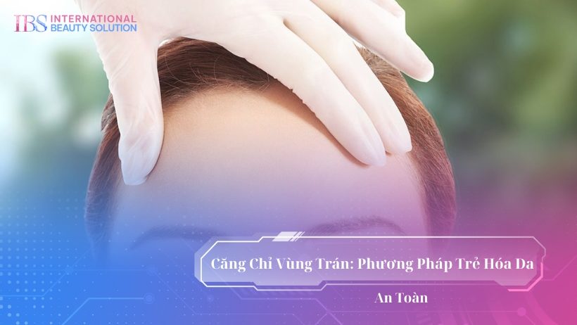 Căng Chỉ Vùng Trán: Phương Pháp Trẻ Hóa Da An Toàn
