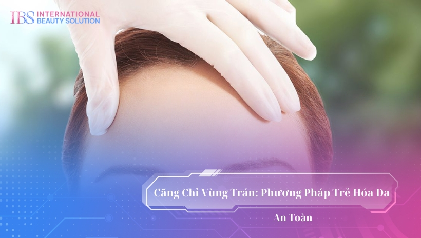 Căng Chỉ Vùng Trán: Phương Pháp Trẻ Hóa Da An Toàn