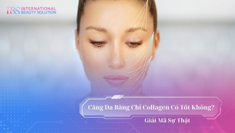 Căng da chỉ collagen có tốt không?