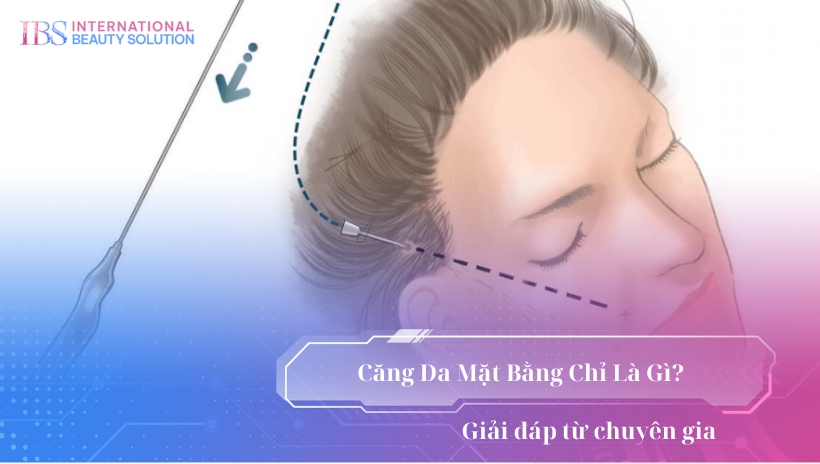 Căng Da Mặt Bằng Chỉ Có Tốt Không? Giải đáp từ chuyên gia