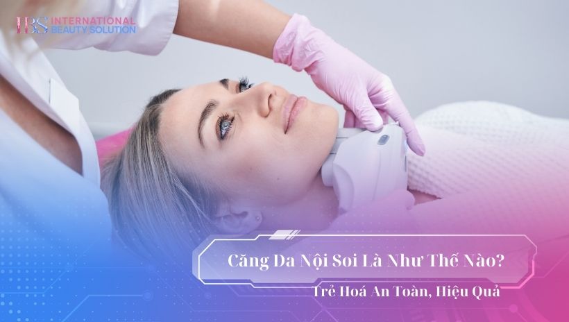 Căng da nội soi là như thế nào