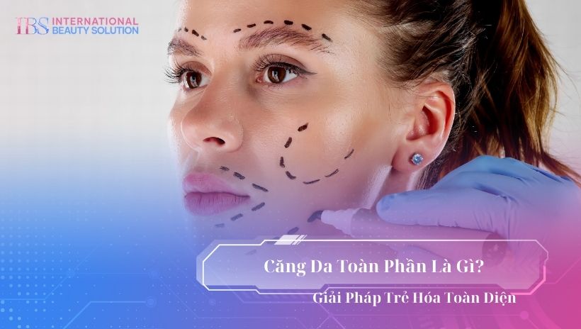 Căng da toàn phần là gì?
