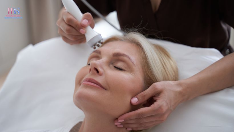 Cấy chỉ collagen hay còn gọi là căng da mặt bằng chỉ sinh học