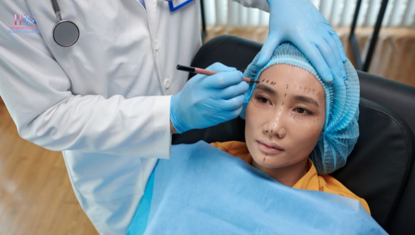 Cấy chỉ là thủ thuật sử dụng các sợi chỉ sinh học cấy vào da để tạo ra hiệu ứng nâng cơ