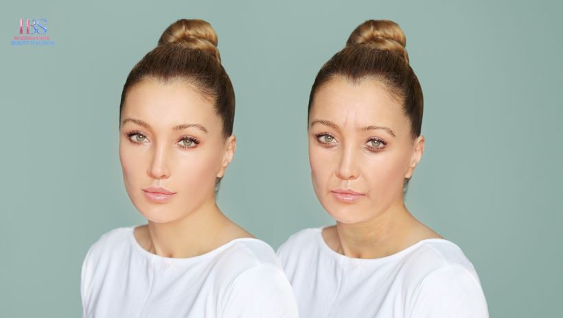 Chăm Sóc Da Sau Khi Xóa Nếp Nhăn Ấn Đường Để Duy Trì Hiệu Quả Lâu Dài