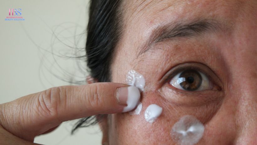 Chăm Sóc Da Sau Liệu Trình Xóa Nếp Nhăn Khóe Mắt