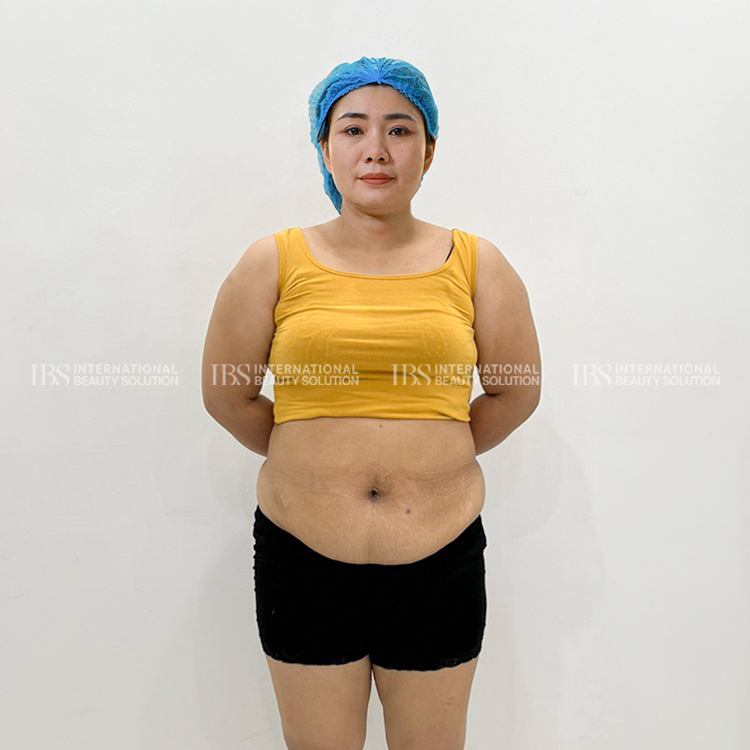 Chị Hồng Nhung trước khi giảm cân