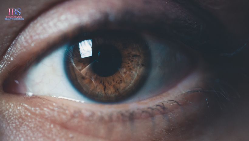 Đối Tượng Phù Hợp Với Cấy Chỉ Làm Đầy Hốc Mắt