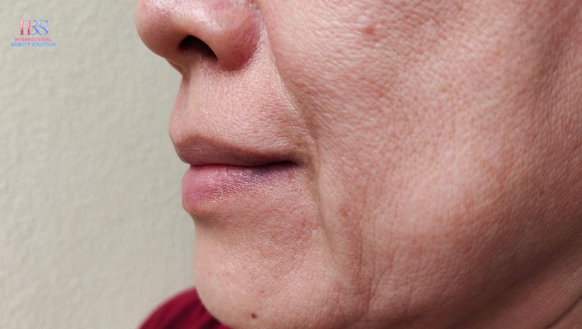 Giải Pháp Công Nghệ Cao Tại Viện Thẩm Mỹ IBS