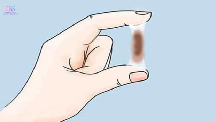 Khí hư máu báo thai màu nâu là gì?