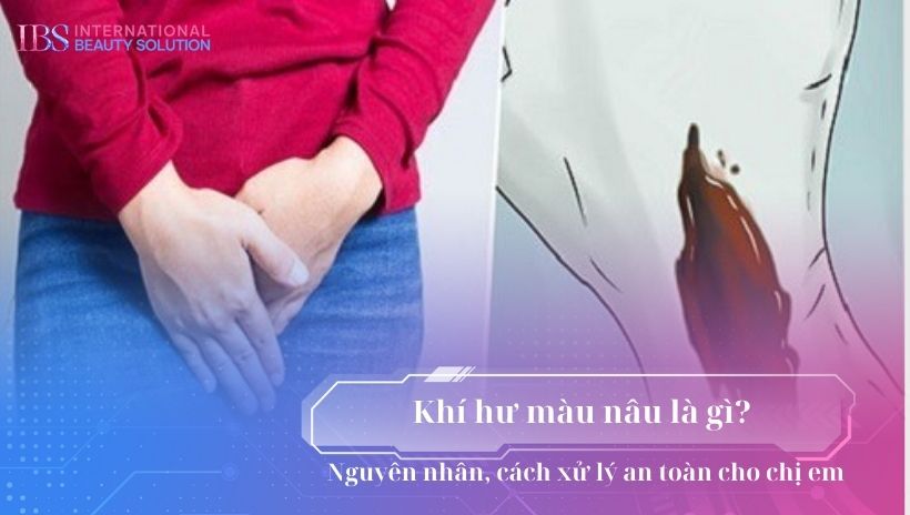 Khí hư màu nâu là gì? Nguyên nhân, cách xử lý an toàn cho chị em