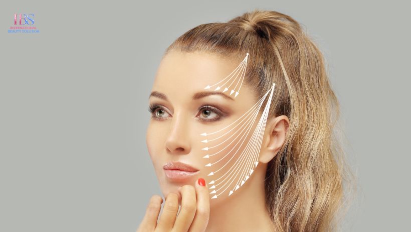 Phương pháp căng chỉ là gì?