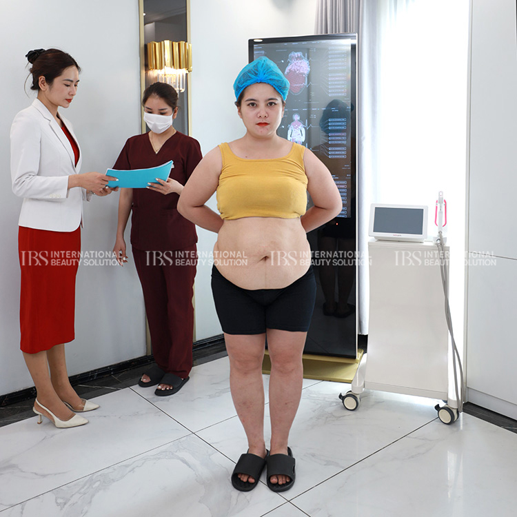 Chị Minh Ngọc trước khi giảm cân