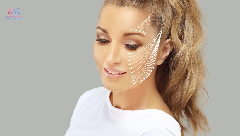 Ưu điểm vượt trội của cấy chỉ collagen