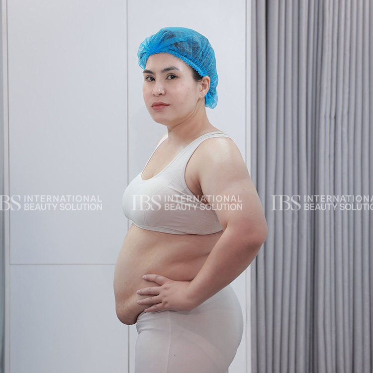 Chị Giang trước khi giảm cân