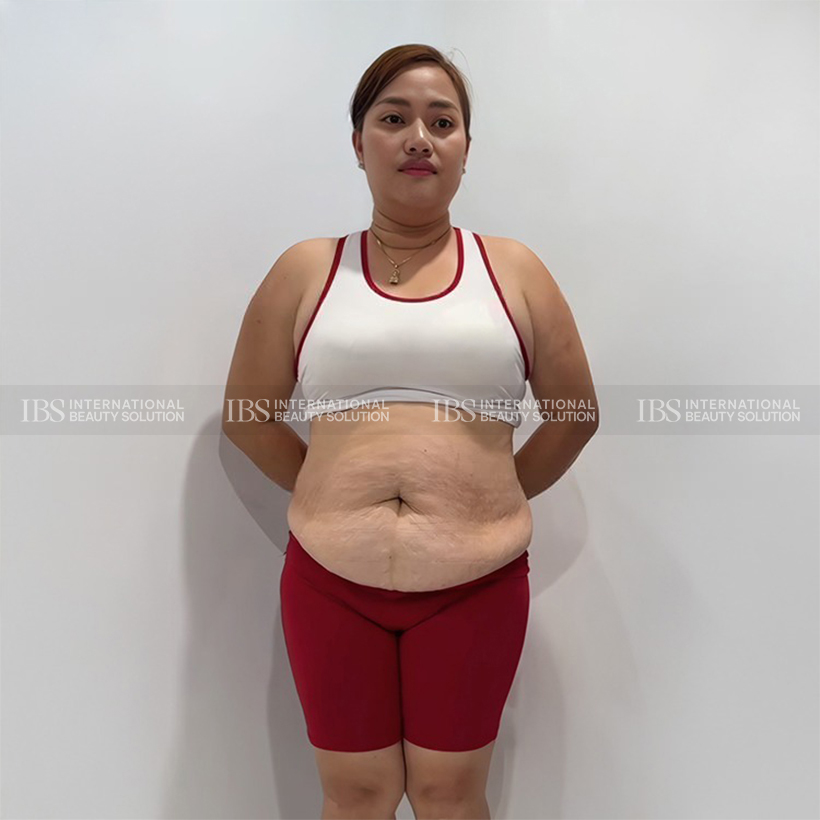 Chị Hải Yến trước khi giảm cân