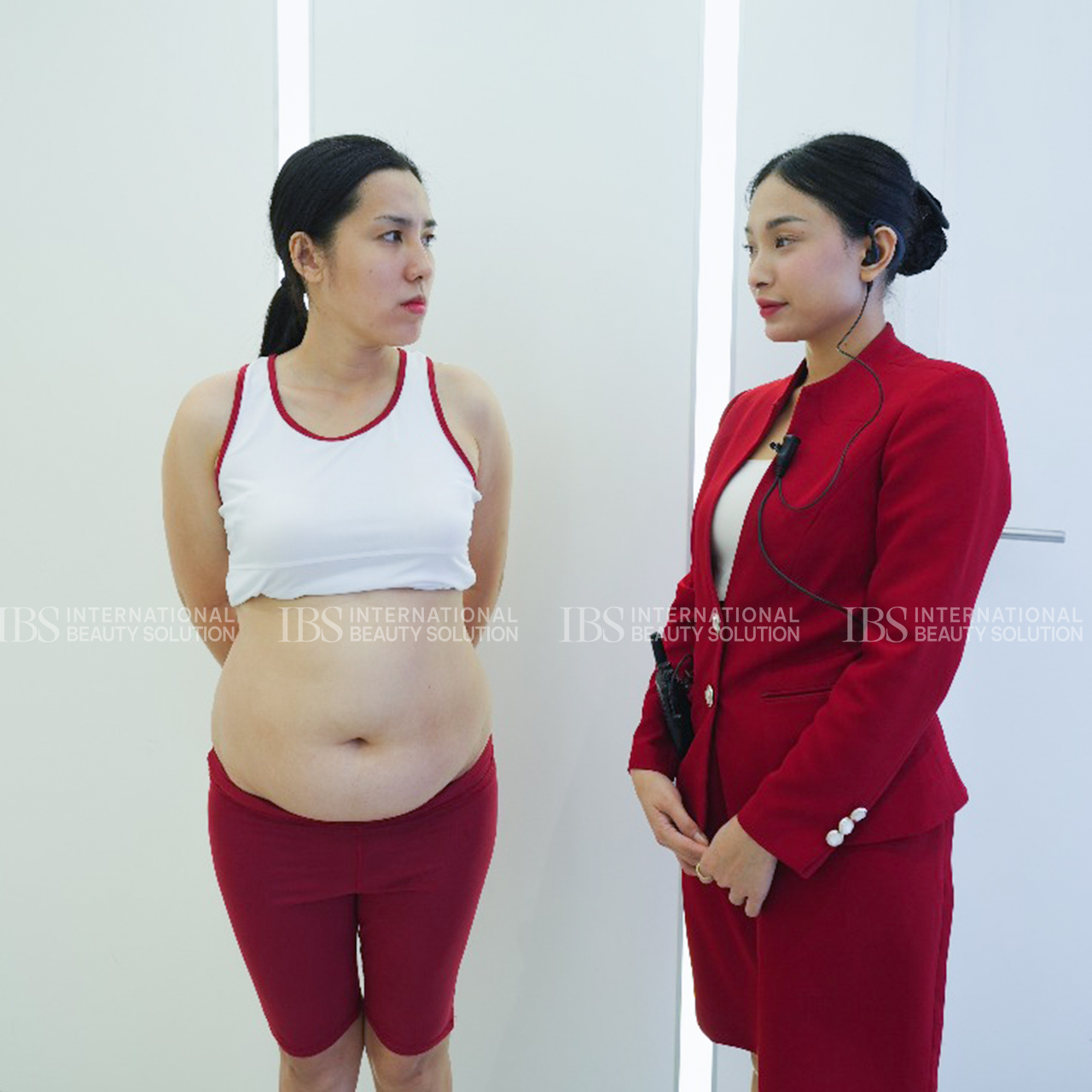 Chị Hạnh Liên trước khi giảm cân tại IBS 