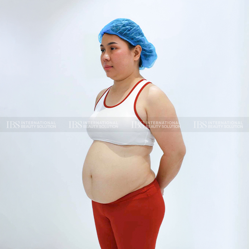 Chị Huyền My trước khi giảm cân