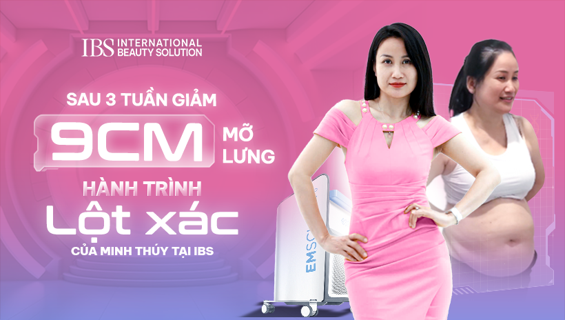 Giảm 9cm Mỡ Lưng Sau 3 Tuần – Hành Trình Lột Xác Của Minh Thúy Tại IBS