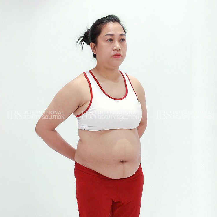 Chị Ngọc Nguyễn trước khi giảm cân 