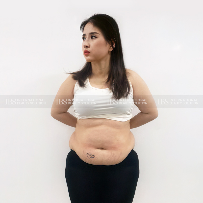 Chị Trà My trước khi giảm cân