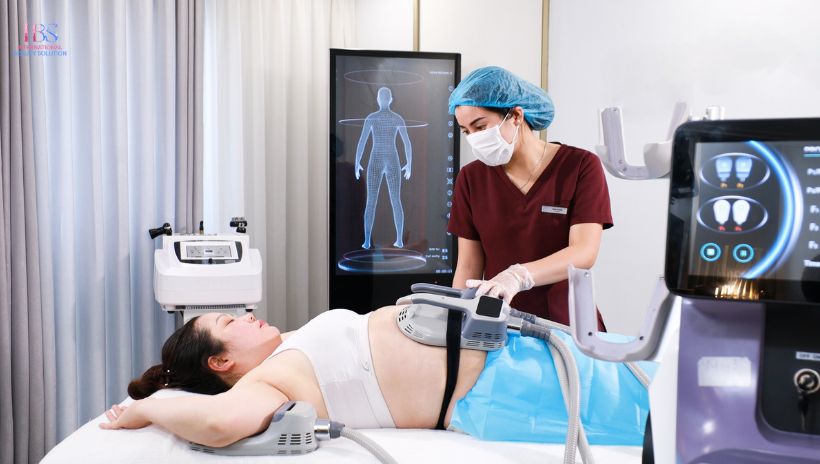Công nghệ giảm mỡ bụng tại IBS