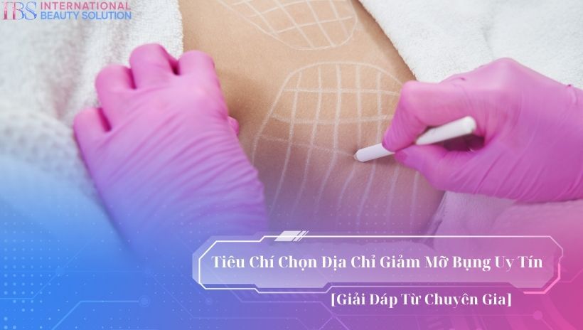 Địa chỉ giảm mỡ bụng uy tín