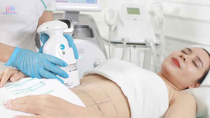 Giảm béo không xâm lấn là gì?