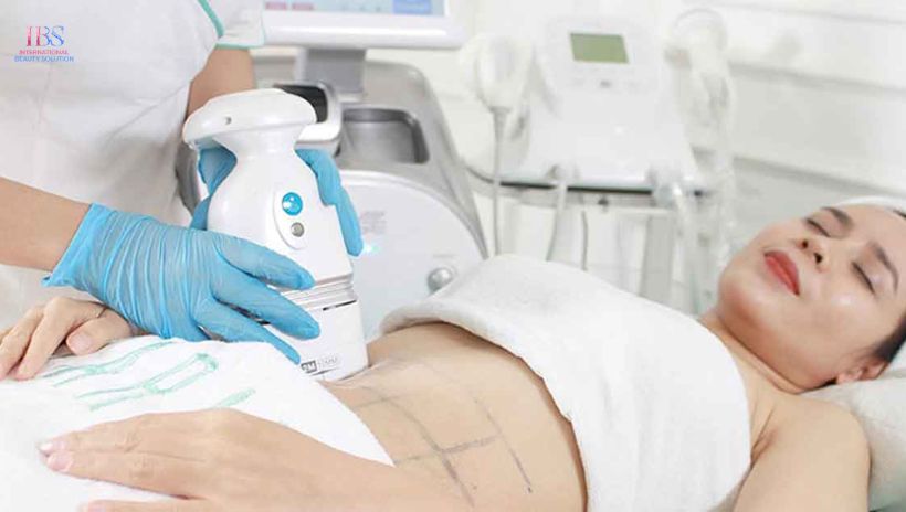 Giảm mỡ bằng công nghệ không xâm lấn an toàn không dao kéo 