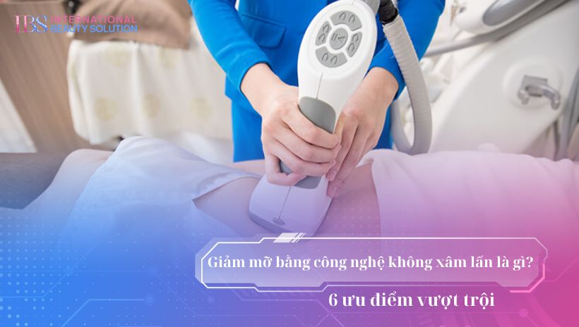 Giảm mỡ bằng công nghệ không xâm lấn là gì? 6 ưu điểm vượt trội 
