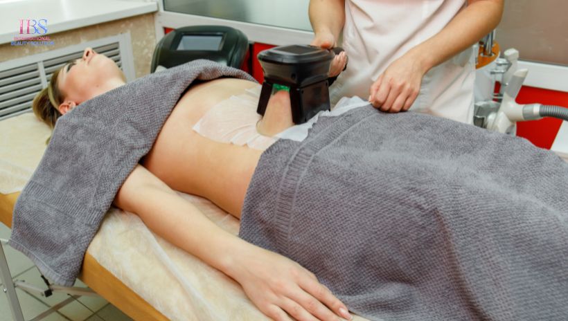 Giảm Mỡ Không Phẫu Thuật Tại IBS