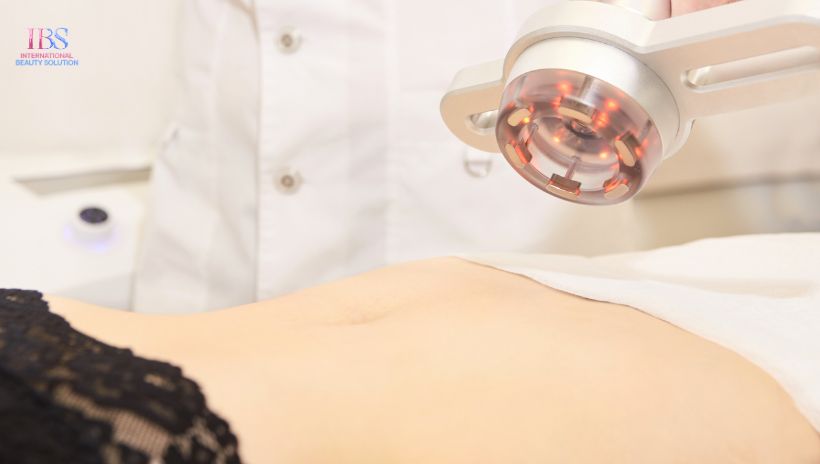 Tại Sao Giảm Mỡ Bụng Bằng Công Nghệ Cao Lại Trở Thành Xu Hướng?