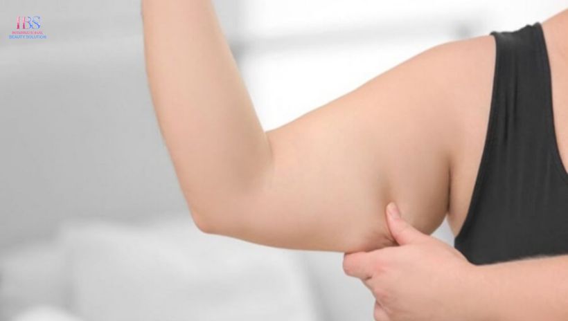 Tại sao mỡ bắp tay là “nỗi ám ảnh” của nhiều người?