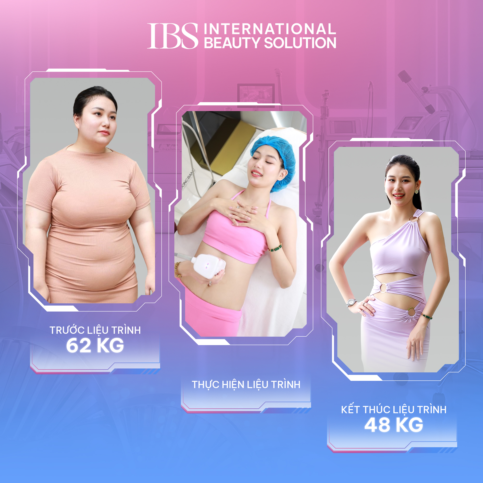 Siết dáng săn chắc da sau giảm cân 