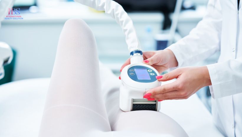 Viện Thẩm Mỹ IBS - Địa Chỉ Giảm Mỡ Công Nghệ Cao Hàng Đầu